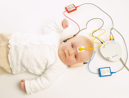 BERA Hearing Test in pune